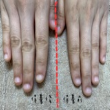 [HyperLink1]